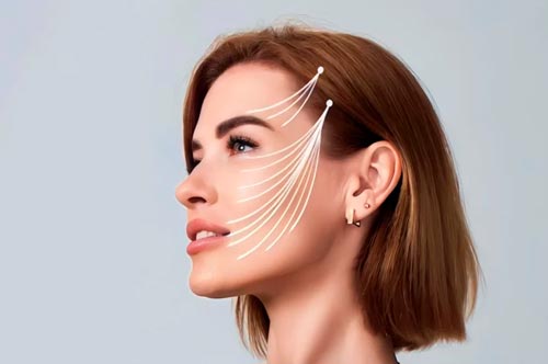 Fios de PDO (Tração)